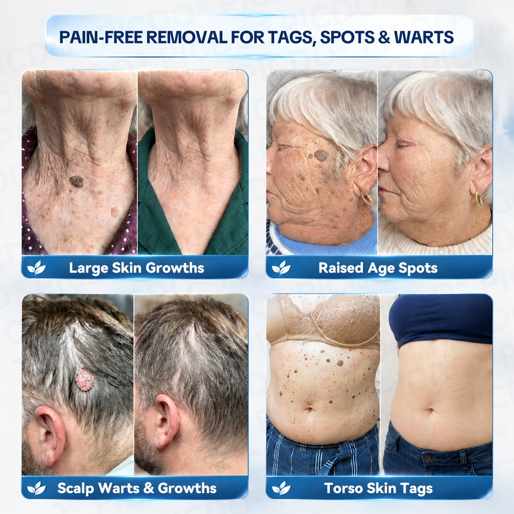 𝐏𝐢𝐜𝐝𝐨® 𝐌𝐚𝐠𝐧𝐞𝐬𝐢𝐮𝐦 𝐑𝐞𝐩𝐚𝐢𝐫 𝐂𝐫𝐞𝐚𝐦 (Zero Pain, Zero 𝐒𝐜𝐚𝐫𝐬 Formula) 💦💦