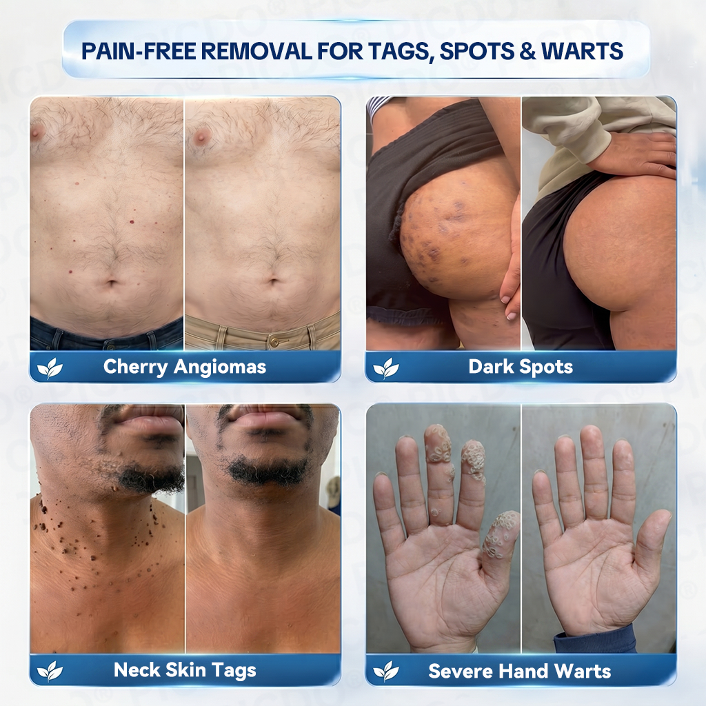 𝐏𝐢𝐜𝐝𝐨® 𝐌𝐚𝐠𝐧𝐞𝐬𝐢𝐮𝐦 𝐑𝐞𝐩𝐚𝐢𝐫 𝐂𝐫𝐞𝐚𝐦 (Zero Pain, Zero 𝐒𝐜𝐚𝐫𝐬 Formula) 💦💦