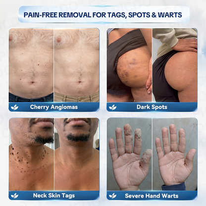 𝐏𝐢𝐜𝐝𝐨® 𝐌𝐚𝐠𝐧𝐞𝐬𝐢𝐮𝐦 𝐑𝐞𝐩𝐚𝐢𝐫 𝐂𝐫𝐞𝐚𝐦 (Zero Pain, Zero 𝐒𝐜𝐚𝐫𝐬 Formula) 💦💦