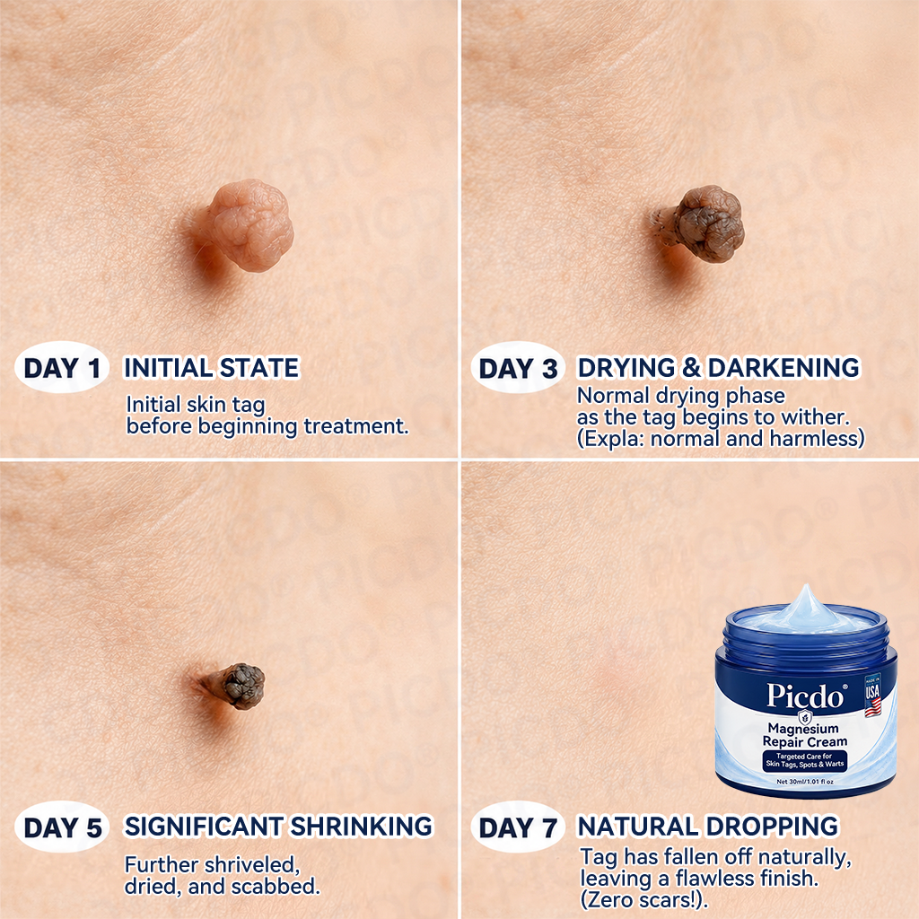 𝐏𝐢𝐜𝐝𝐨® 𝐌𝐚𝐠𝐧𝐞𝐬𝐢𝐮𝐦 𝐑𝐞𝐩𝐚𝐢𝐫 𝐂𝐫𝐞𝐚𝐦 (Zero Pain, Zero 𝐒𝐜𝐚𝐫𝐬 Formula) 💦💦