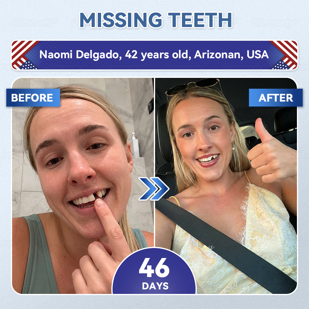 𝐆𝐥𝐢𝐦𝐦𝐞𝐫𝐥𝐲® 𝐓𝐢𝐝𝐞𝐠𝐥𝐮𝐬𝐢𝐛 𝐓𝐨𝐨𝐭𝐡 & 𝐆𝐮𝐦 𝐑𝐞𝐩𝐚𝐢𝐫 𝐌𝐢𝐜𝐫𝐨𝐧𝐞𝐞𝐝𝐥𝐞 𝐏𝐚𝐭𝐜𝐡  | 𝐀𝐝𝐯𝐚𝐧𝐜𝐞𝐝 𝐒𝐭𝐞𝐦-𝐂𝐞𝐥𝐥 𝐀𝐜𝐭𝐢𝐯𝐚𝐭𝐢𝐨𝐧 𝐓𝐞𝐞𝐭𝐡 𝐒𝐭𝐫𝐢𝐩𝐬(🦷𝐑𝐞𝐛𝐮𝐢𝐥𝐝 𝐄𝐧𝐚𝐦𝐞𝐥 & 𝐃𝐞𝐧𝐭𝐢𝐧 • 𝐒𝐭𝐫𝐞𝐧𝐠𝐭𝐡𝐞𝐧 𝐆𝐮𝐦𝐬 • 𝐄𝐫𝐚𝐝𝐢𝐜𝐚𝐭𝐞 𝐓𝐚𝐫𝐭𝐚𝐫 & 𝐎𝐝𝐨𝐫 • 𝐒𝐭𝐨𝐩 𝐓𝐨𝐨𝐭𝐡 𝐒𝐞𝐧𝐬𝐢𝐭𝐢𝐯𝐢𝐭𝐲) 🌹