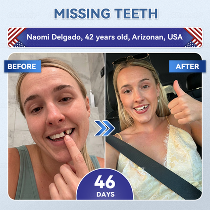 𝐆𝐥𝐢𝐦𝐦𝐞𝐫𝐥𝐲® 𝐓𝐢𝐝𝐞𝐠𝐥𝐮𝐬𝐢𝐛 𝐓𝐨𝐨𝐭𝐡 & 𝐆𝐮𝐦 𝐑𝐞𝐩𝐚𝐢𝐫 𝐌𝐢𝐜𝐫𝐨𝐧𝐞𝐞𝐝𝐥𝐞 𝐏𝐚𝐭𝐜𝐡  | 𝐀𝐝𝐯𝐚𝐧𝐜𝐞𝐝 𝐒𝐭𝐞𝐦-𝐂𝐞𝐥𝐥 𝐀𝐜𝐭𝐢𝐯𝐚𝐭𝐢𝐨𝐧 𝐓𝐞𝐞𝐭𝐡 𝐒𝐭𝐫𝐢𝐩𝐬(🦷𝐑𝐞𝐛𝐮𝐢𝐥𝐝 𝐄𝐧𝐚𝐦𝐞𝐥 & 𝐃𝐞𝐧𝐭𝐢𝐧 • 𝐒𝐭𝐫𝐞𝐧𝐠𝐭𝐡𝐞𝐧 𝐆𝐮𝐦𝐬 • 𝐄𝐫𝐚𝐝𝐢𝐜𝐚𝐭𝐞 𝐓𝐚𝐫𝐭𝐚𝐫 & 𝐎𝐝𝐨𝐫 • 𝐒𝐭𝐨𝐩 𝐓𝐨𝐨𝐭𝐡 𝐒𝐞𝐧𝐬𝐢𝐭𝐢𝐯𝐢𝐭𝐲) 🌹