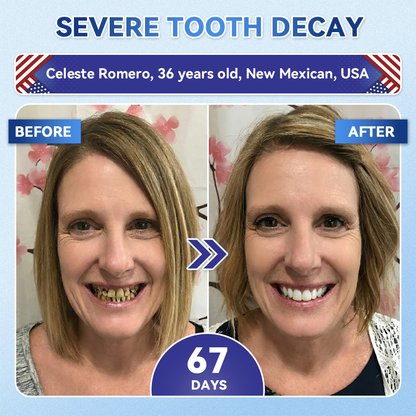 𝐆𝐥𝐢𝐦𝐦𝐞𝐫𝐥𝐲® 𝐓𝐢𝐝𝐞𝐠𝐥𝐮𝐬𝐢𝐛 𝐓𝐨𝐨𝐭𝐡 & 𝐆𝐮𝐦 𝐑𝐞𝐩𝐚𝐢𝐫 𝐌𝐢𝐜𝐫𝐨𝐧𝐞𝐞𝐝𝐥𝐞 𝐏𝐚𝐭𝐜𝐡  | 𝐀𝐝𝐯𝐚𝐧𝐜𝐞𝐝 𝐒𝐭𝐞𝐦-𝐂𝐞𝐥𝐥 𝐀𝐜𝐭𝐢𝐯𝐚𝐭𝐢𝐨𝐧 𝐓𝐞𝐞𝐭𝐡 𝐒𝐭𝐫𝐢𝐩𝐬(🦷𝐑𝐞𝐛𝐮𝐢𝐥𝐝 𝐄𝐧𝐚𝐦𝐞𝐥 & 𝐃𝐞𝐧𝐭𝐢𝐧 • 𝐒𝐭𝐫𝐞𝐧𝐠𝐭𝐡𝐞𝐧 𝐆𝐮𝐦𝐬 • 𝐄𝐫𝐚𝐝𝐢𝐜𝐚𝐭𝐞 𝐓𝐚𝐫𝐭𝐚𝐫 & 𝐎𝐝𝐨𝐫 • 𝐒𝐭𝐨𝐩 𝐓𝐨𝐨𝐭𝐡 𝐒𝐞𝐧𝐬𝐢𝐭𝐢𝐯𝐢𝐭𝐲) 2.0