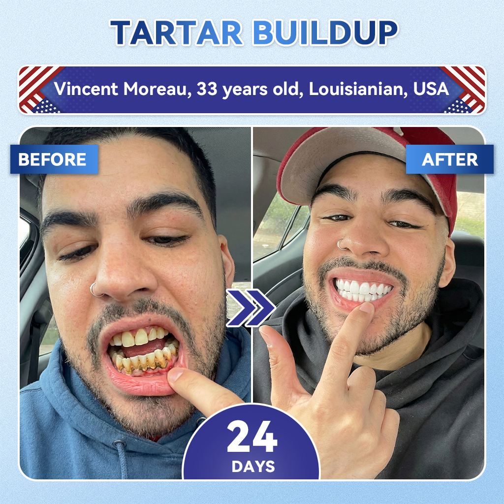 𝑶𝒇𝒇𝒊𝒄𝒊𝒂𝒍 𝑺𝒕𝒐𝒓𝒆 | 𝐺𝑙𝑖𝑚𝑚𝑒𝑟𝑙𝑦® 𝑇𝑖𝑑𝑒𝑔𝑙𝑢𝑠𝑖𝑏 𝑇𝑜𝑜𝑡ℎ & 𝐺𝑢𝑚 𝑅𝑒𝑝𝑎𝑖𝑟 𝐹𝑎𝑠𝑡-𝐷𝑖𝑠𝑠𝑜𝑙𝑣𝑖𝑛𝑔 𝑂𝑟𝑎𝑙 𝑆𝑡𝑟𝑖𝑝𝑠 🌹