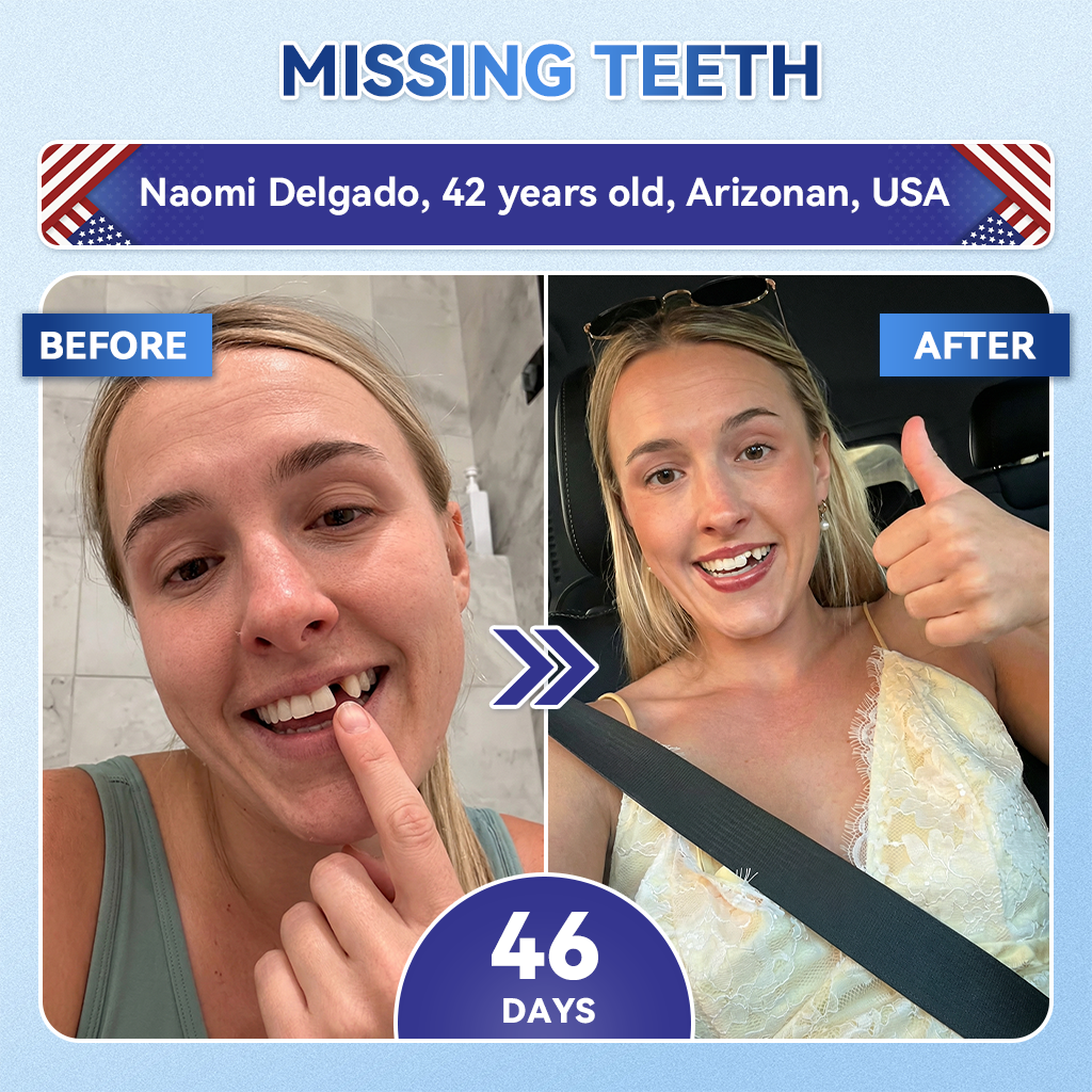 𝐆𝐥𝐢𝐦𝐦𝐞𝐫𝐥𝐲® 𝐓𝐢𝐝𝐞𝐠𝐥𝐮𝐬𝐢𝐛 𝐓𝐨𝐨𝐭𝐡 & 𝐆𝐮𝐦 𝐑𝐞𝐩𝐚𝐢𝐫 𝐌𝐢𝐜𝐫𝐨𝐧𝐞𝐞𝐝𝐥𝐞 𝐏𝐚𝐭𝐜𝐡  | 𝐀𝐝𝐯𝐚𝐧𝐜𝐞𝐝 𝐒𝐭𝐞𝐦-𝐂𝐞𝐥𝐥 𝐀𝐜𝐭𝐢𝐯𝐚𝐭𝐢𝐨𝐧 𝐓𝐞𝐞𝐭𝐡 𝐒𝐭𝐫𝐢𝐩𝐬(🦷𝐑𝐞𝐛𝐮𝐢𝐥𝐝 𝐄𝐧𝐚𝐦𝐞𝐥 & 𝐃𝐞𝐧𝐭𝐢𝐧 • 𝐒𝐭𝐫𝐞𝐧𝐠𝐭𝐡𝐞𝐧 𝐆𝐮𝐦𝐬 • 𝐄𝐫𝐚𝐝𝐢𝐜𝐚𝐭𝐞 𝐓𝐚𝐫𝐭𝐚𝐫 & 𝐎𝐝𝐨𝐫 • 𝐒𝐭𝐨𝐩 𝐓𝐨𝐨𝐭𝐡 𝐒𝐞𝐧𝐬𝐢𝐭𝐢𝐯𝐢𝐭𝐲) 3.0