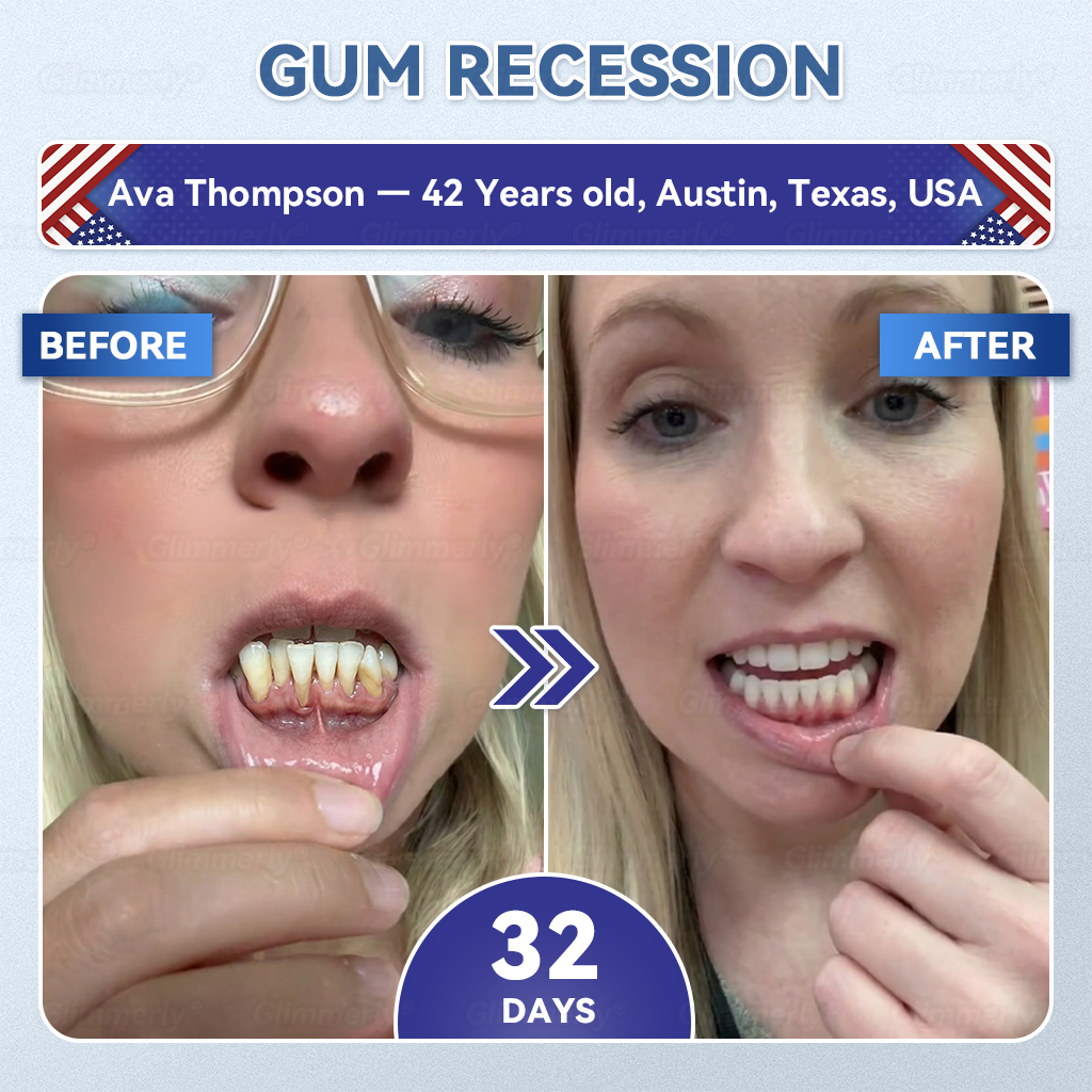 𝐆𝐥𝐢𝐦𝐦𝐞𝐫𝐥𝐲® 𝐓𝐢𝐝𝐞𝐠𝐥𝐮𝐬𝐢𝐛 𝐓𝐨𝐨𝐭𝐡 & 𝐆𝐮𝐦 𝐑𝐞𝐩𝐚𝐢𝐫 𝐌𝐢𝐜𝐫𝐨𝐧𝐞𝐞𝐝𝐥𝐞 𝐏𝐚𝐭𝐜𝐡  | 𝐀𝐝𝐯𝐚𝐧𝐜𝐞𝐝 𝐒𝐭𝐞𝐦-𝐂𝐞𝐥𝐥 𝐀𝐜𝐭𝐢𝐯𝐚𝐭𝐢𝐨𝐧 𝐓𝐞𝐞𝐭𝐡 𝐒𝐭𝐫𝐢𝐩𝐬(🦷𝐑𝐞𝐛𝐮𝐢𝐥𝐝 𝐄𝐧𝐚𝐦𝐞𝐥 & 𝐃𝐞𝐧𝐭𝐢𝐧 • 𝐒𝐭𝐫𝐞𝐧𝐠𝐭𝐡𝐞𝐧 𝐆𝐮𝐦𝐬 • 𝐄𝐫𝐚𝐝𝐢𝐜𝐚𝐭𝐞 𝐓𝐚𝐫𝐭𝐚𝐫 & 𝐎𝐝𝐨𝐫 • 𝐒𝐭𝐨𝐩 𝐓𝐨𝐨𝐭𝐡 𝐒𝐞𝐧𝐬𝐢𝐭𝐢𝐯𝐢𝐭𝐲) 🌹