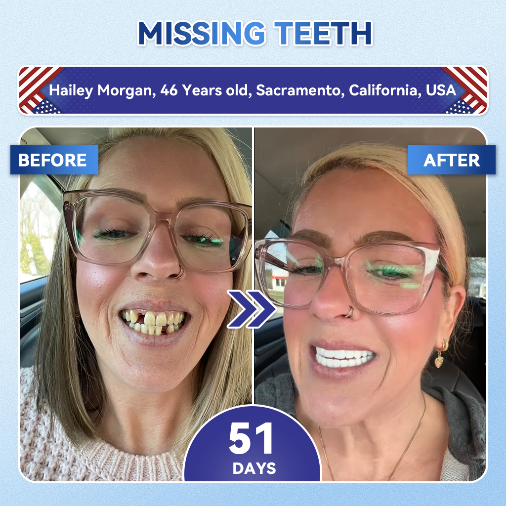 𝐆𝐥𝐢𝐦𝐦𝐞𝐫𝐥𝐲® 𝐓𝐢𝐝𝐞𝐠𝐥𝐮𝐬𝐢𝐛 𝐓𝐨𝐨𝐭𝐡 & 𝐆𝐮𝐦 𝐑𝐞𝐩𝐚𝐢𝐫 𝐌𝐢𝐜𝐫𝐨𝐧𝐞𝐞𝐝𝐥𝐞 𝐏𝐚𝐭𝐜𝐡  | 𝐀𝐝𝐯𝐚𝐧𝐜𝐞𝐝 𝐒𝐭𝐞𝐦-𝐂𝐞𝐥𝐥 𝐀𝐜𝐭𝐢𝐯𝐚𝐭𝐢𝐨𝐧 𝐓𝐞𝐞𝐭𝐡 𝐒𝐭𝐫𝐢𝐩𝐬(🦷𝐑𝐞𝐛𝐮𝐢𝐥𝐝 𝐄𝐧𝐚𝐦𝐞𝐥 & 𝐃𝐞𝐧𝐭𝐢𝐧 • 𝐒𝐭𝐫𝐞𝐧𝐠𝐭𝐡𝐞𝐧 𝐆𝐮𝐦𝐬 • 𝐄𝐫𝐚𝐝𝐢𝐜𝐚𝐭𝐞 𝐓𝐚𝐫𝐭𝐚𝐫 & 𝐎𝐝𝐨𝐫 • 𝐒𝐭𝐨𝐩 𝐓𝐨𝐨𝐭𝐡 𝐒𝐞𝐧𝐬𝐢𝐭𝐢𝐯𝐢𝐭𝐲) 3.0