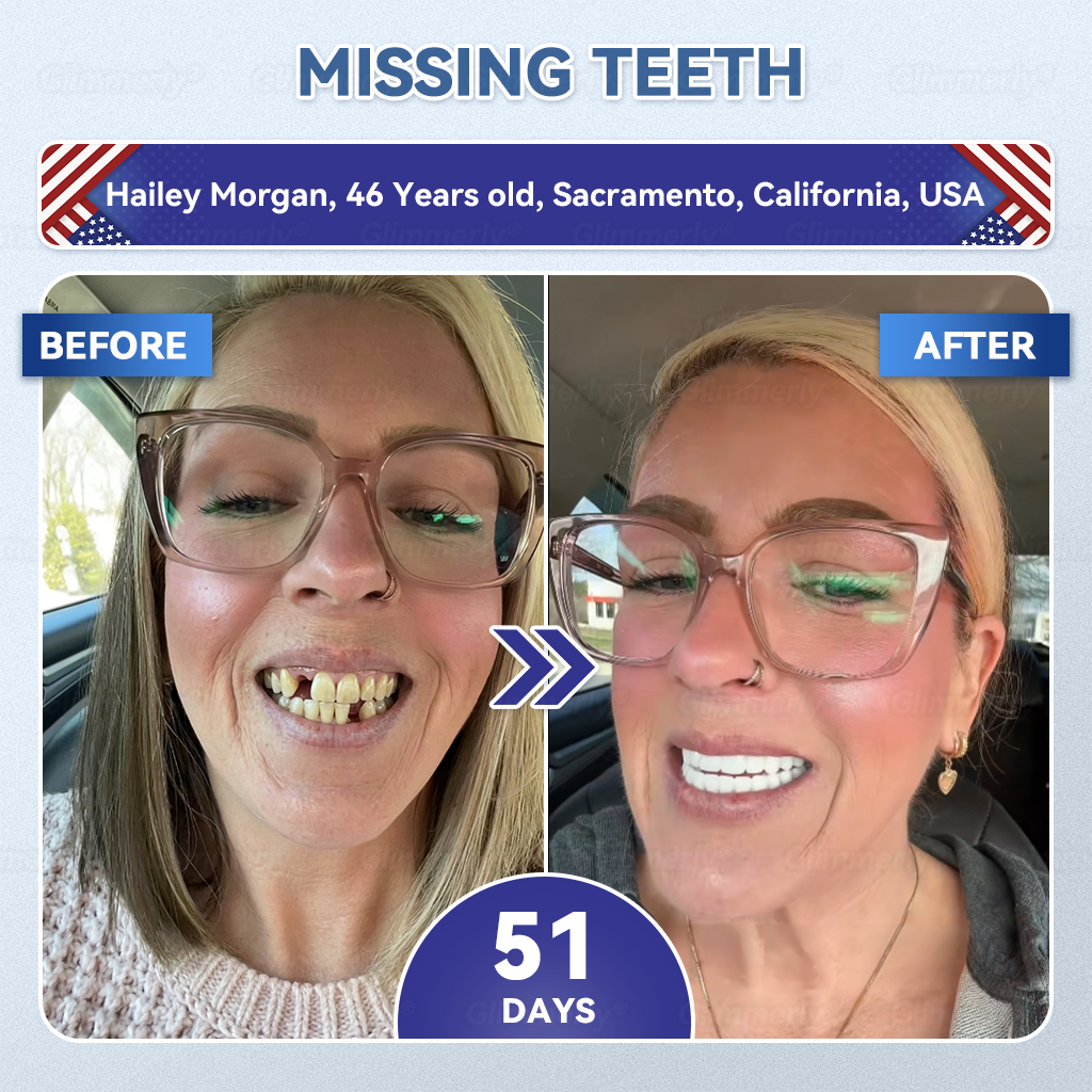 𝐆𝐥𝐢𝐦𝐦𝐞𝐫𝐥𝐲® 𝐓𝐢𝐝𝐞𝐠𝐥𝐮𝐬𝐢𝐛 𝐓𝐨𝐨𝐭𝐡 & 𝐆𝐮𝐦 𝐑𝐞𝐩𝐚𝐢𝐫 𝐌𝐢𝐜𝐫𝐨𝐧𝐞𝐞𝐝𝐥𝐞 𝐏𝐚𝐭𝐜𝐡  | 𝐀𝐝𝐯𝐚𝐧𝐜𝐞𝐝 𝐒𝐭𝐞𝐦-𝐂𝐞𝐥𝐥 𝐀𝐜𝐭𝐢𝐯𝐚𝐭𝐢𝐨𝐧 𝐓𝐞𝐞𝐭𝐡 𝐒𝐭𝐫𝐢𝐩𝐬(🦷𝐑𝐞𝐛𝐮𝐢𝐥𝐝 𝐄𝐧𝐚𝐦𝐞𝐥 & 𝐃𝐞𝐧𝐭𝐢𝐧 • 𝐒𝐭𝐫𝐞𝐧𝐠𝐭𝐡𝐞𝐧 𝐆𝐮𝐦𝐬 • 𝐄𝐫𝐚𝐝𝐢𝐜𝐚𝐭𝐞 𝐓𝐚𝐫𝐭𝐚𝐫 & 𝐎𝐝𝐨𝐫 • 𝐒𝐭𝐨𝐩 𝐓𝐨𝐨𝐭𝐡 𝐒𝐞𝐧𝐬𝐢𝐭𝐢𝐯𝐢𝐭𝐲) 🌹
