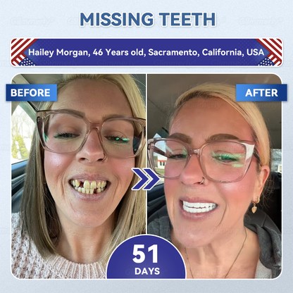 𝐆𝐥𝐢𝐦𝐦𝐞𝐫𝐥𝐲® 𝐓𝐢𝐝𝐞𝐠𝐥𝐮𝐬𝐢𝐛 𝐓𝐨𝐨𝐭𝐡 & 𝐆𝐮𝐦 𝐑𝐞𝐩𝐚𝐢𝐫 𝐌𝐢𝐜𝐫𝐨𝐧𝐞𝐞𝐝𝐥𝐞 𝐏𝐚𝐭𝐜𝐡  | 𝐀𝐝𝐯𝐚𝐧𝐜𝐞𝐝 𝐒𝐭𝐞𝐦-𝐂𝐞𝐥𝐥 𝐀𝐜𝐭𝐢𝐯𝐚𝐭𝐢𝐨𝐧 𝐓𝐞𝐞𝐭𝐡 𝐒𝐭𝐫𝐢𝐩𝐬(🦷𝐑𝐞𝐛𝐮𝐢𝐥𝐝 𝐄𝐧𝐚𝐦𝐞𝐥 & 𝐃𝐞𝐧𝐭𝐢𝐧 • 𝐒𝐭𝐫𝐞𝐧𝐠𝐭𝐡𝐞𝐧 𝐆𝐮𝐦𝐬 • 𝐄𝐫𝐚𝐝𝐢𝐜𝐚𝐭𝐞 𝐓𝐚𝐫𝐭𝐚𝐫 & 𝐎𝐝𝐨𝐫 • 𝐒𝐭𝐨𝐩 𝐓𝐨𝐨𝐭𝐡 𝐒𝐞𝐧𝐬𝐢𝐭𝐢𝐯𝐢𝐭𝐲) 🌹