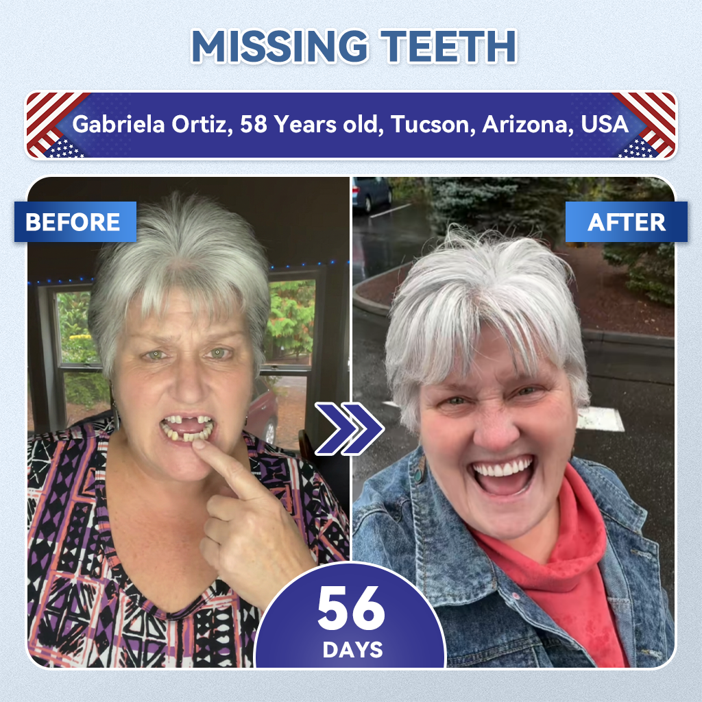 𝐆𝐥𝐢𝐦𝐦𝐞𝐫𝐥𝐲® 𝐓𝐢𝐝𝐞𝐠𝐥𝐮𝐬𝐢𝐛 𝐓𝐨𝐨𝐭𝐡 & 𝐆𝐮𝐦 𝐑𝐞𝐩𝐚𝐢𝐫 𝐌𝐢𝐜𝐫𝐨𝐧𝐞𝐞𝐝𝐥𝐞 𝐏𝐚𝐭𝐜𝐡  | 𝐀𝐝𝐯𝐚𝐧𝐜𝐞𝐝 𝐒𝐭𝐞𝐦-𝐂𝐞𝐥𝐥 𝐀𝐜𝐭𝐢𝐯𝐚𝐭𝐢𝐨𝐧 𝐓𝐞𝐞𝐭𝐡 𝐒𝐭𝐫𝐢𝐩𝐬(🦷𝐑𝐞𝐛𝐮𝐢𝐥𝐝 𝐄𝐧𝐚𝐦𝐞𝐥 & 𝐃𝐞𝐧𝐭𝐢𝐧 • 𝐒𝐭𝐫𝐞𝐧𝐠𝐭𝐡𝐞𝐧 𝐆𝐮𝐦𝐬 • 𝐄𝐫𝐚𝐝𝐢𝐜𝐚𝐭𝐞 𝐓𝐚𝐫𝐭𝐚𝐫 & 𝐎𝐝𝐨𝐫 • 𝐒𝐭𝐨𝐩 𝐓𝐨𝐨𝐭𝐡 𝐒𝐞𝐧𝐬𝐢𝐭𝐢𝐯𝐢𝐭𝐲) 🌹