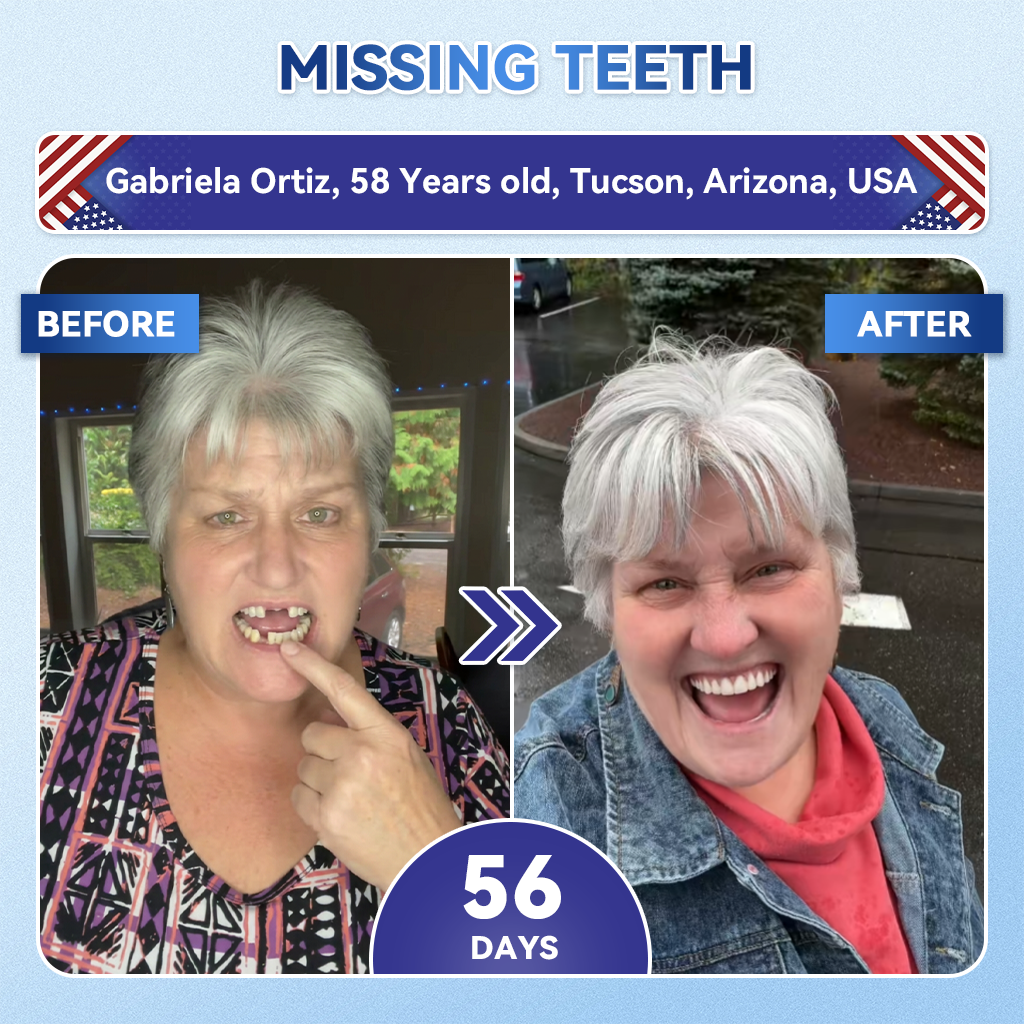 𝐆𝐥𝐢𝐦𝐦𝐞𝐫𝐥𝐲® 𝐓𝐢𝐝𝐞𝐠𝐥𝐮𝐬𝐢𝐛 𝐓𝐨𝐨𝐭𝐡 & 𝐆𝐮𝐦 𝐑𝐞𝐩𝐚𝐢𝐫 𝐌𝐢𝐜𝐫𝐨𝐧𝐞𝐞𝐝𝐥𝐞 𝐏𝐚𝐭𝐜𝐡  | 𝐀𝐝𝐯𝐚𝐧𝐜𝐞𝐝 𝐒𝐭𝐞𝐦-𝐂𝐞𝐥𝐥 𝐀𝐜𝐭𝐢𝐯𝐚𝐭𝐢𝐨𝐧 𝐓𝐞𝐞𝐭𝐡 𝐒𝐭𝐫𝐢𝐩𝐬(🦷𝐑𝐞𝐛𝐮𝐢𝐥𝐝 𝐄𝐧𝐚𝐦𝐞𝐥 & 𝐃𝐞𝐧𝐭𝐢𝐧 • 𝐒𝐭𝐫𝐞𝐧𝐠𝐭𝐡𝐞𝐧 𝐆𝐮𝐦𝐬 • 𝐄𝐫𝐚𝐝𝐢𝐜𝐚𝐭𝐞 𝐓𝐚𝐫𝐭𝐚𝐫 & 𝐎𝐝𝐨𝐫 • 𝐒𝐭𝐨𝐩 𝐓𝐨𝐨𝐭𝐡 𝐒𝐞𝐧𝐬𝐢𝐭𝐢𝐯𝐢𝐭𝐲) 3.0