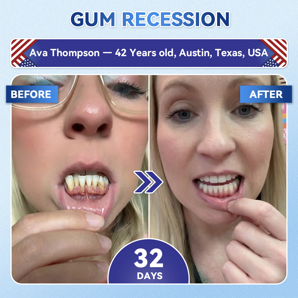 𝐆𝐥𝐢𝐦𝐦𝐞𝐫𝐥𝐲® 𝐓𝐢𝐝𝐞𝐠𝐥𝐮𝐬𝐢𝐛 𝐓𝐨𝐨𝐭𝐡 & 𝐆𝐮𝐦 𝐑𝐞𝐩𝐚𝐢𝐫 𝐌𝐢𝐜𝐫𝐨𝐧𝐞𝐞𝐝𝐥𝐞 𝐏𝐚𝐭𝐜𝐡  | 𝐀𝐝𝐯𝐚𝐧𝐜𝐞𝐝 𝐒𝐭𝐞𝐦-𝐂𝐞𝐥𝐥 𝐀𝐜𝐭𝐢𝐯𝐚𝐭𝐢𝐨𝐧 𝐓𝐞𝐞𝐭𝐡 𝐒𝐭𝐫𝐢𝐩𝐬(🦷𝐑𝐞𝐛𝐮𝐢𝐥𝐝 𝐄𝐧𝐚𝐦𝐞𝐥 & 𝐃𝐞𝐧𝐭𝐢𝐧 • 𝐒𝐭𝐫𝐞𝐧𝐠𝐭𝐡𝐞𝐧 𝐆𝐮𝐦𝐬 • 𝐄𝐫𝐚𝐝𝐢𝐜𝐚𝐭𝐞 𝐓𝐚𝐫𝐭𝐚𝐫 & 𝐎𝐝𝐨𝐫 • 𝐒𝐭𝐨𝐩 𝐓𝐨𝐨𝐭𝐡 𝐒𝐞𝐧𝐬𝐢𝐭𝐢𝐯𝐢𝐭𝐲) 3.0